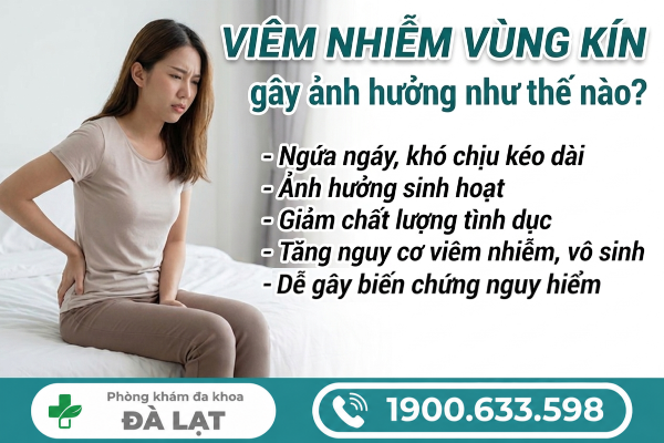 Hình ảnh minh họa